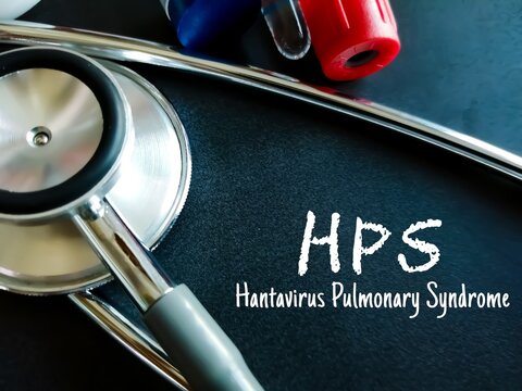 Hantavirus pulmonary syndrome is a rare infection by Hantavirus that begins with flu like symptoms and progresses rapidly to more severe disease.