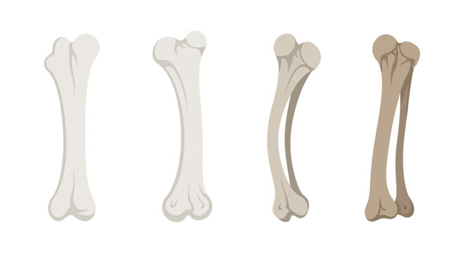 Four Stages of Bone Evolution: From Healthy to Fossilized