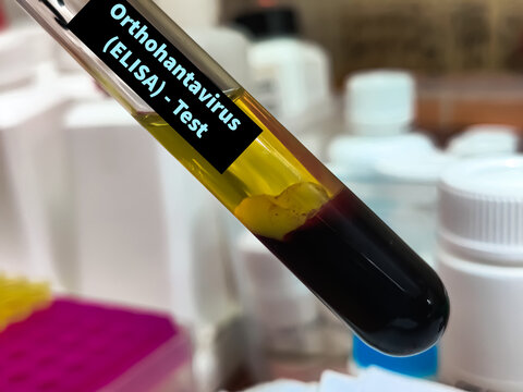 Biological Specimen blood test for detecting IgM and IgG antibodies (ELISA) or molecular PCR tests to detect viral RNA of Orthohantavirus or Hantavirus.