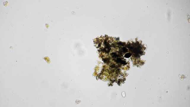 Wet sample reveals dense organic material indicating pollution concern in water. Observation of aggregated algae and organic debris points towards possible water quality impairment