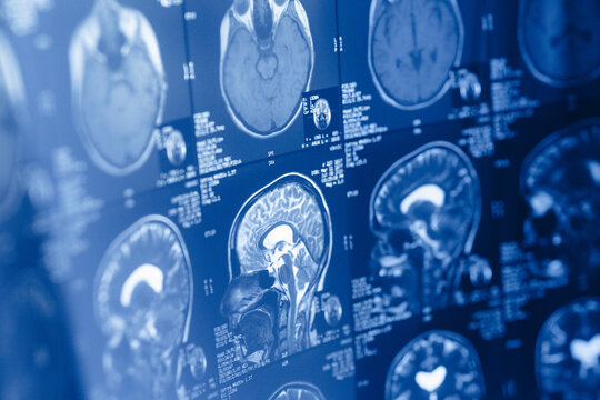 Medical imaging displays brain scans showing various sections of the human brain for analysis and review in a clinical setting