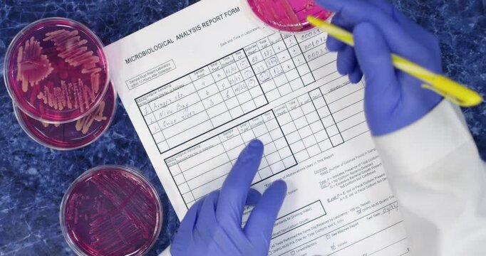 A scientist makes notes on a lab form and examines Petri dishes containing bacterial colonies. Recording research results in microbiology.