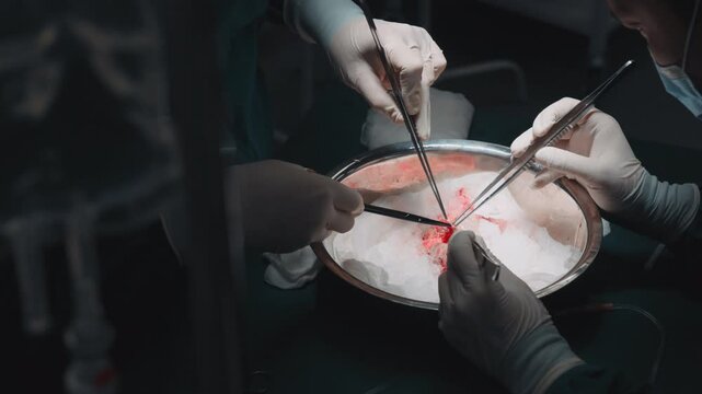 Surgeons preparing donor kidney for transplantation during surgical procedure, close up of medical team working with organ in sterile operating room under surgical lights
