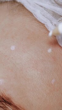 Beauty injection aging botulinum therapy facial rejuvenation forehead marks for collagen injections