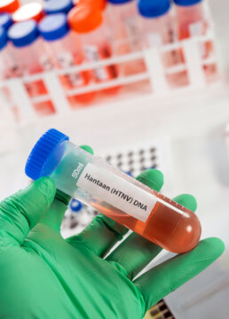 An epidemiologist holds a vial containing a sample for hantavirus virus analysis in a laboratory
