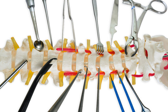 Cervical spine model with anterior discectomy and stabilization tools. Anatomical vertebral column showing specialized surgical instruments used for decompression and spinal fusion procedures in neuro
