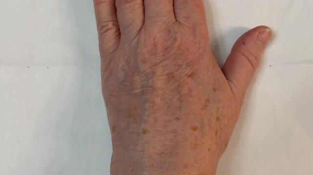 Aged White Woman's Hand Closeup Showing Uncut Nails, Brown Age Spots, Pronounced Wrinkles And Visible Veins, Resting On Neutral Fabric Background Under Soft Natural Light, High Texture Detail