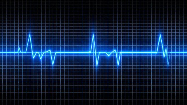 Electrocardiogram reading on a screen.