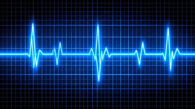 Electrocardiogram heartbeat rhythm on grid background.
