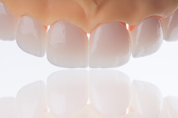 High-quality six dental crowns made of zirconium for fixation to the frontal teeth of upper jaw. © gorynvd