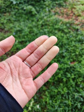 Raynaud's disease (syndrome). Hands of a young woman suffering from raynaud's phenomenon. Green background.Scleroderma