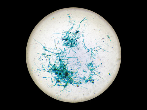 Rhizopus nigricans is a fungus that grows saprophytically on bread, steamed buns, and rice; it is a microorganism frequently utilized in fermentation processes. Magnification: 25&times;.
