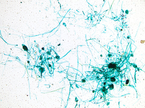Rhizopus nigricans is a fungus that grows saprophytically on bread, steamed buns, and rice; it is a microorganism frequently utilized in fermentation processes. Magnify: 40&times;.
