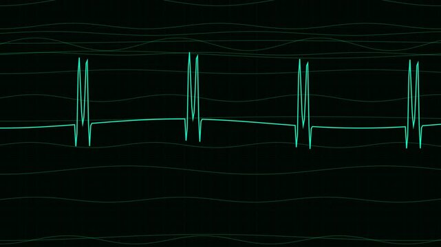 This animated graphic displays a pulsing heart rhythm on a dark screen with subtle wave motion. The electrocardiogram visual is a continuous loop.