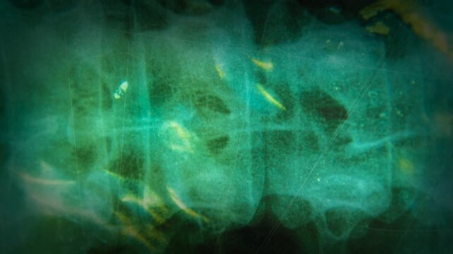 Grunge spine xray scan with noise and distressed texture. Abstract medical radiology background with spinal anatomy, dark cinematic healthcare concept.