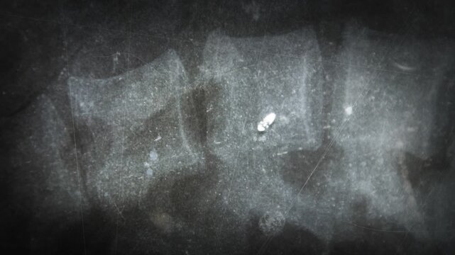 Grunge spine xray scan with noise and distressed texture. Abstract medical radiology background with spinal anatomy, dark cinematic healthcare concept.