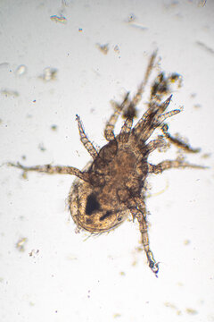 Microscopic View of a Soil Mite Arachnid