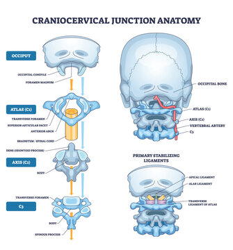 Craniocervical junction anatomy illustrates relationships of occiput, atlas (C1), and axis (C2), conveying skull spine alignment and motion control. Outline diagram