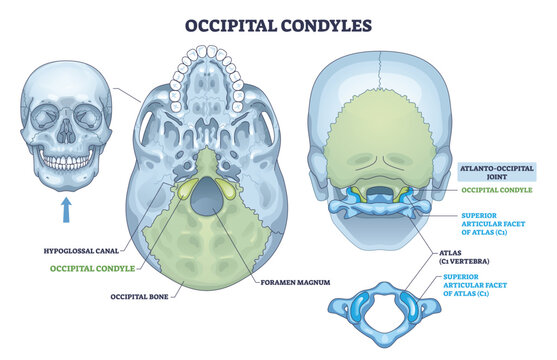 Occipital condyles outline depicts skull base landmarks foramen magnum, atlas C1, and atlanto-occipital joint clarifying head neck articulation and nerve passage. Outline diagram
