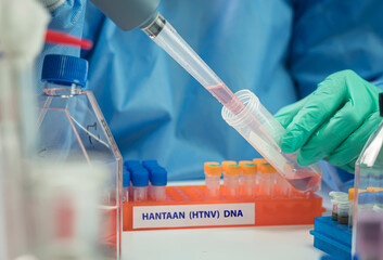 Health scientist conducts research to analyse the hantavirus epidemics in the laboratory
