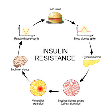 Insulin resistance infographic. From blood glucose spikes to cellular starvation. Understanding the cycle of insulin and leptin resistance.
