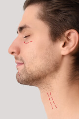 Fototapeta premium Young man with marked face on light background, closeup. Plastic surgery concept