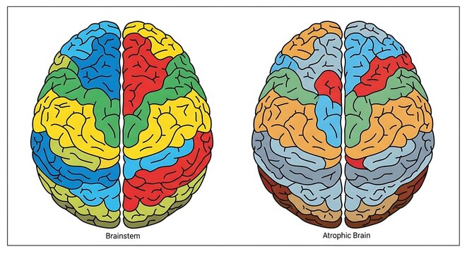Colorful Brain Anatomy Side by Side Compare