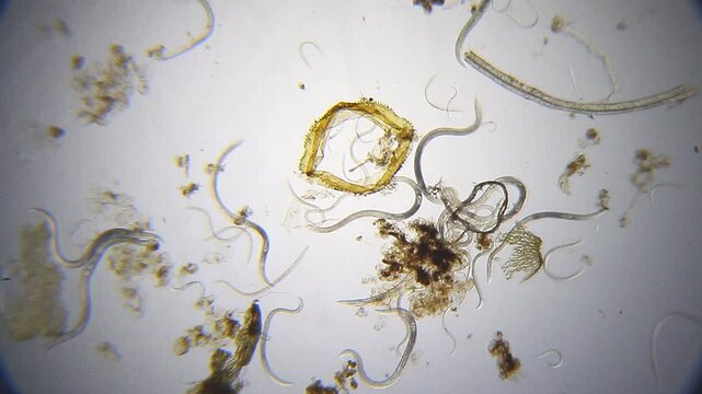Nematodes actively moving in water droplet under 40x magnification brightfield microscopy. 4K scientific microscopy footage.