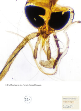 Female Aedes mosquitoes subsist on the blood of humans or animals and are capable of transmitting diseases, including Japanese encephalitis and other arboviruses. Magnification: 25&times;.
