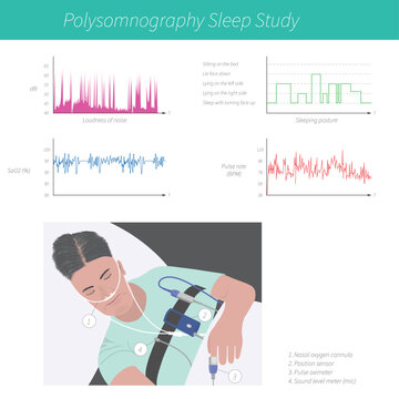 Polysomnography Sleep Study Infographic with Patient Sensors and Vital Signs Graphs