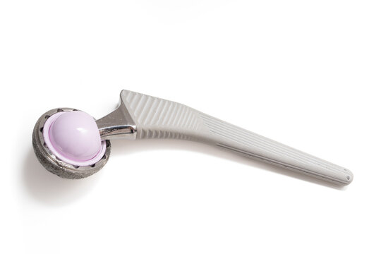 Metallic Hip Prosthesis with Femoral Head Replacement