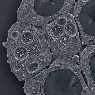 Inhaled Synthetic Nanospheres Internalized in Pulmonary Cells Ion-Abrasion Scanning Electron Micrograph Medical Research and Health