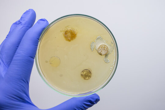 Columns with bacteria on a Petri dish with bacterial victims, a method for testing the antibiotic properties of producers.