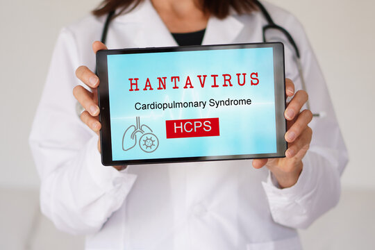 HANTAVIRUS, Cardiopulmonary Syndrome, hcps. healthcare professional showing a digital tablet