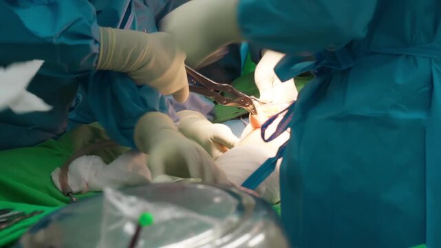 Doctor or orthopedic surgeon in green uniform holding medical scalpel or knife inside operating room. Hand with medical glove.