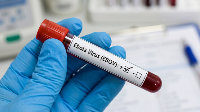Hand in Blue Glove Holding Ebola Virus (EBOV) Positive Blood Sample