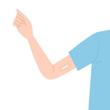 Contraception method. Vector flat female arm with inserted contraceptive implant. Birth control for women and pregnancy prevention. Contraceptive patch on arm