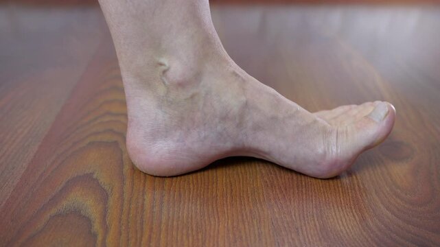 Person applying topical pain relief ointment on ankle. Closeup view of a person applying a soothing gel on their ankle to relieve muscle pain, showing visible veins and bone structure