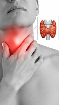 Anatomical visualization of the thyroid gland, combined with a person experiencing severe throat discomfort, highlighting symptoms of thyroid disease, a common endocrine disorder, medical health