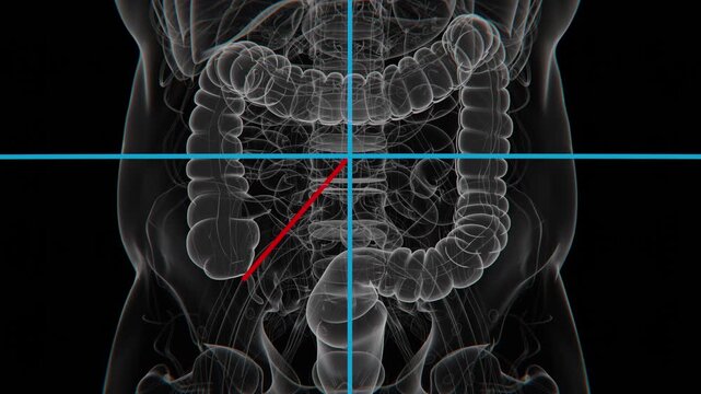 McBurney&rsquo;s Point test is a clinical examination used to identify appendicitis by checking for localized tenderness in the lower right abdomen in 4K