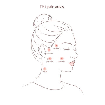 TMJ pain areas map vector illustration