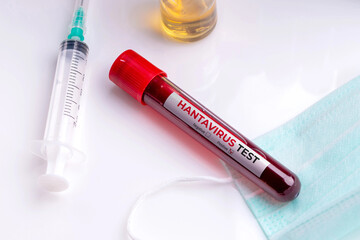 Naklejka premium Blood sample in test tube for Hantavirus laboratory analysis with medical equipment
