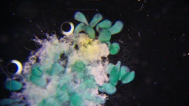 Stentor ciliates attached to substrate feeding on bacteria under 40x magnification darkfield microscopy. 4K scientific microscopy footage.