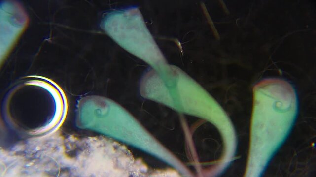Stentor ciliates attached to substrate feeding on bacteria under 100x magnification darkfield microscopy. 4K scientific microscopy footage.