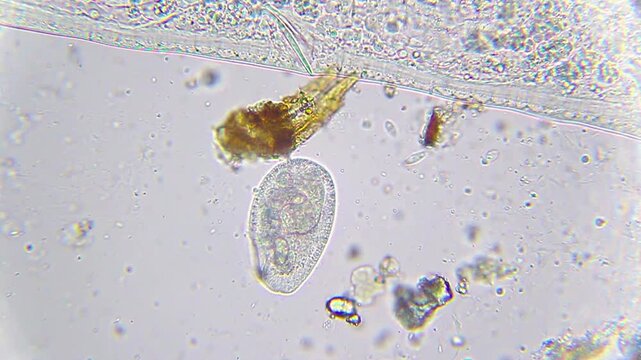 Paramecium caudatum feeding on bacteria under 400x magnification brightfield microscopy. 4K scientific microscopy footage.