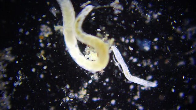 Annelid worms actively moving under 40x magnification darkfield microscopy. 4K scientific microscopy footage.