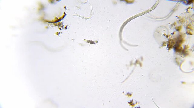Ciliate swimming near nematodes under 100x magnification brightfield microscopy. 4K scientific microscopy footage.