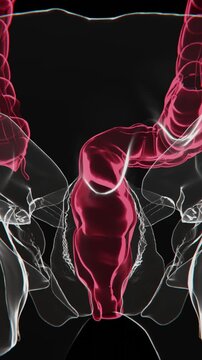 Showing Hemorrhoids are swollen and inflamed veins in the rectum | Hemorrhoids Video in Vertical Xray Video