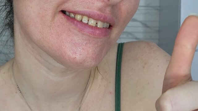 Woman with yellow plaque on teeth showing a thumbs up, dental hygiene problem and checkup concept, Monitor health care