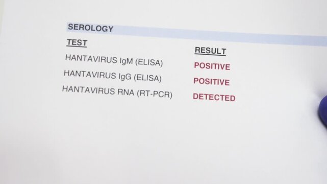 A serology report clearly shows positive results for Hantavirus IgM, IgG, and RNA tests. Suitable for medical presentations or educational content.